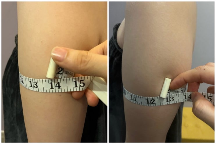  범계 평촌 웨딩케어, 경락, 비만관리 전문 씨엘오비스에서 날씬한 팔뚝 만들고 왔어요