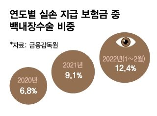 노년 질병 백내장, 40~50대 수술 급증 배경은 ?