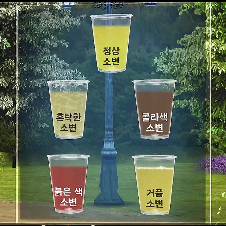 (건강다큐) 과한 운동, 과식, 약물남용, 고혈압에 콩팥이 망가진다. KBS 생로병사의 비밀 817회. (건강다큐) 과한 운동, 과식, 약물남용, 고혈압에 콩팥이 망가진다. KBS 생로병사의 비밀 817회.