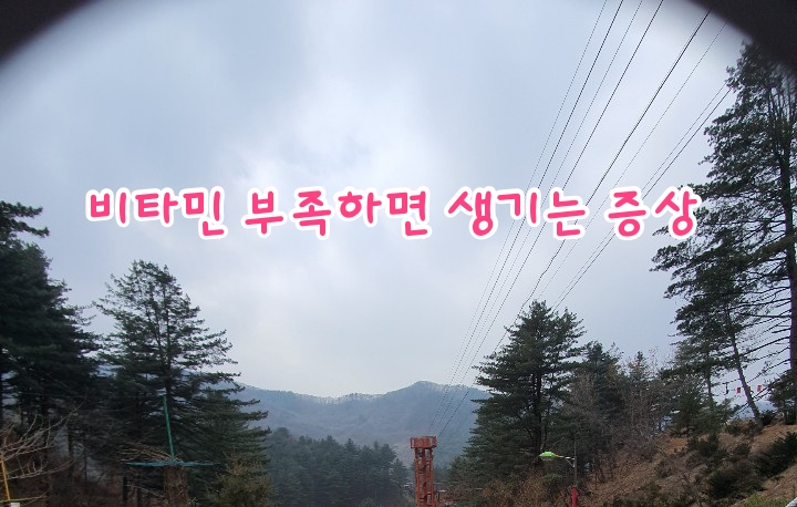 비타민 부족하면 생기는 증상! 비타민 부족하면 생기는 증상!