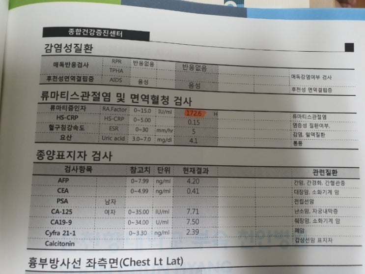  천안 순천향대병원 류마티스내과 진료 후기