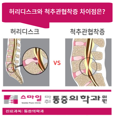  [일산허리통증치료병원] 허리디스크 VS 척추관협착증