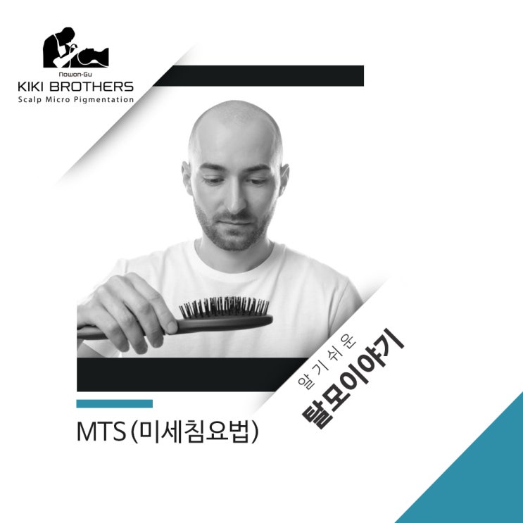  알기 쉬운 탈모이야기(11) MTS(미세침요법)