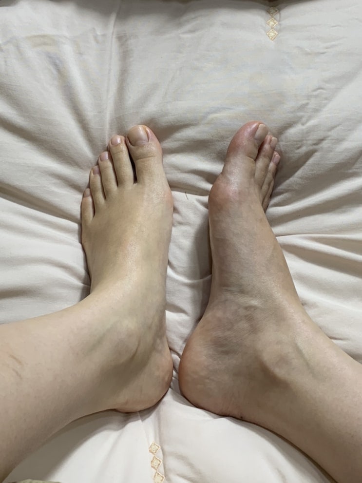  의정부 패디플래닝 발각질제거 : 에스뷰티샵