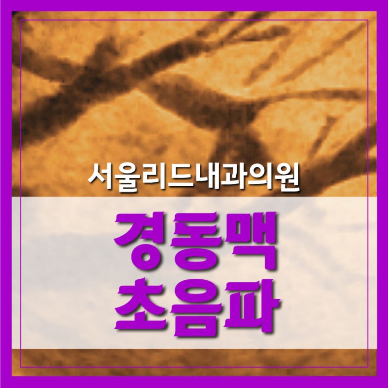 [성남 내과] 급성 심근경색 9