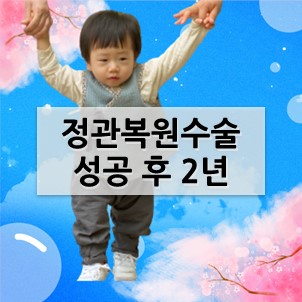 정관복원수술 성공 후 2년