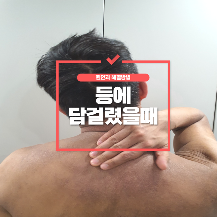  등에 담걸렸을때, 왜 걸리고 어떻게 풀면 좋을까?