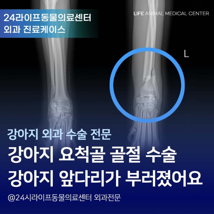 대구 강아지 수술전문 동물병원 : 강아지 앞다리 골절 수술 / 강아지 앞다리가 부러졌어요! 24시라이프동물의료센터