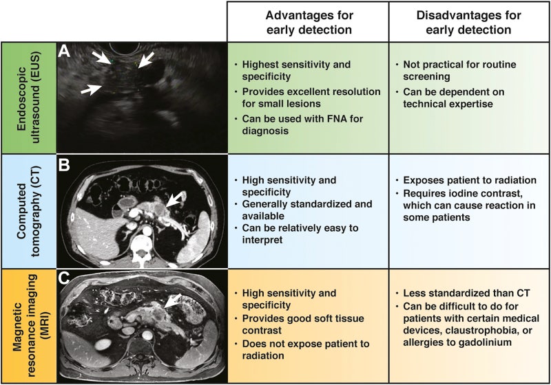 췌장암의 진단과 검사: 췌장 MRI (Diagnosis of Pancreatic Cancer: MRI) : 네이버 블로그
