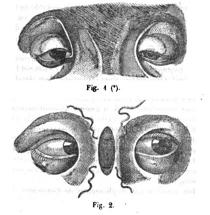  epicanthischen Lehre(몽고주름학설) vs epicanthus hypothesis(몽고주름가설)