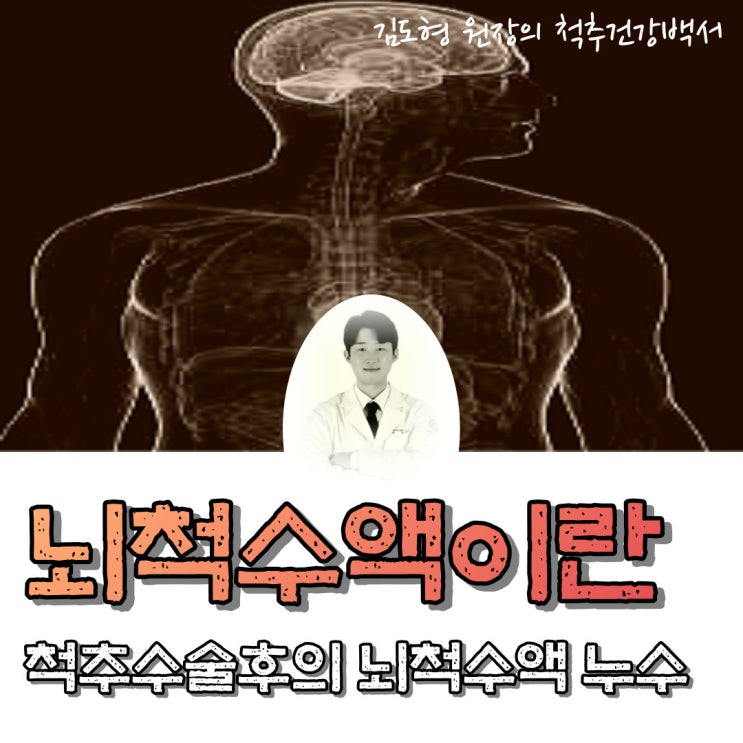 뇌척수액이란? 척추수술 후 뇌척수액 누수에 대하여..