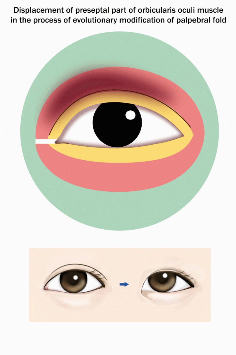 8. Denial of Epicanthischen Lehre(Epicanthus hypothesis) 기형학적 몽고주름 가설의 부인 :  네이버 블로그, image size:800x1200