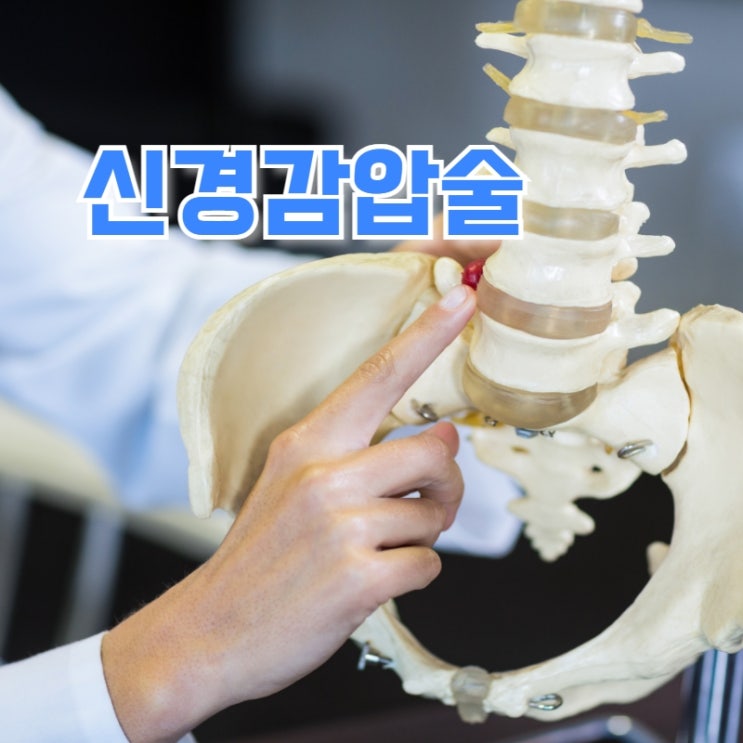  척추관협착증 증상 시술 신경감압술이란?
