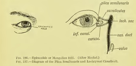  6-1.Succession of idea of epicanthus : Fetalization theory(A modified idea of Hemmungsbildung)