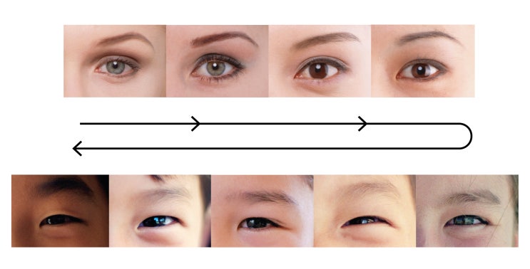  9. The  classification of the epicanthus :  relationship between epicanthus and  palpebral fold