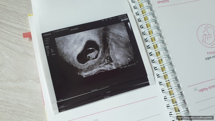 임신일기② 산전진료 7주차, 심장이 두근두근 (도봉구 에이치큐브병원 김예니과장님 산전진료 후기)
