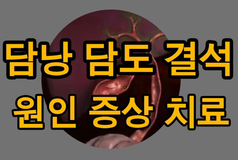 담낭 담도 쓸개 위치 역할 염증 용종 결석 담석 제거 수술 후 : 네이버 블로그
