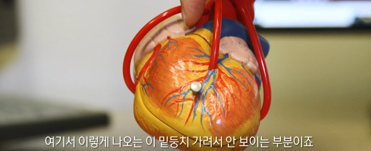  심장재활 해야하는 이유
