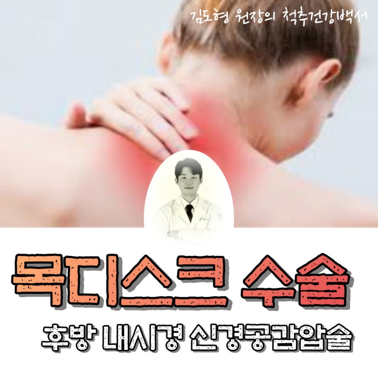  목디스크 수술적치료1 (후방접근법, 내시경 후궁감압술 및 디스크 제거술)