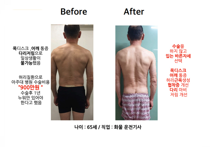  병원 수술비만 9백만원, 65세 화물 운전기사님의 허리질환 : 자세교정사례