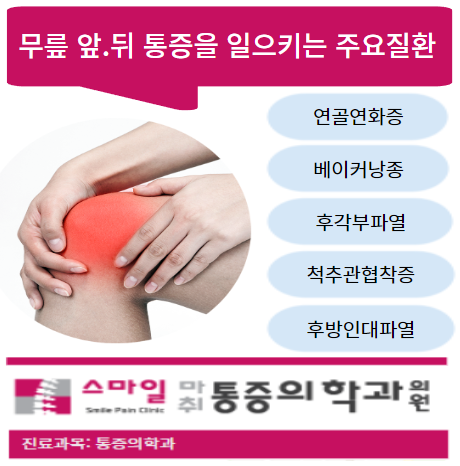  [무릎 아플때] 무릎 앞쪽통증, 뒤쪽통증이 느껴진다면...
