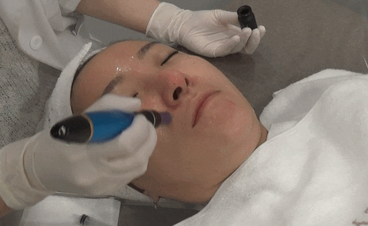 북수원피부관리 현뷰티에서 엑소덤으로 모공 관리 후기 북수원피부관리 현뷰티에서 엑소덤으로 모공 관리 후기