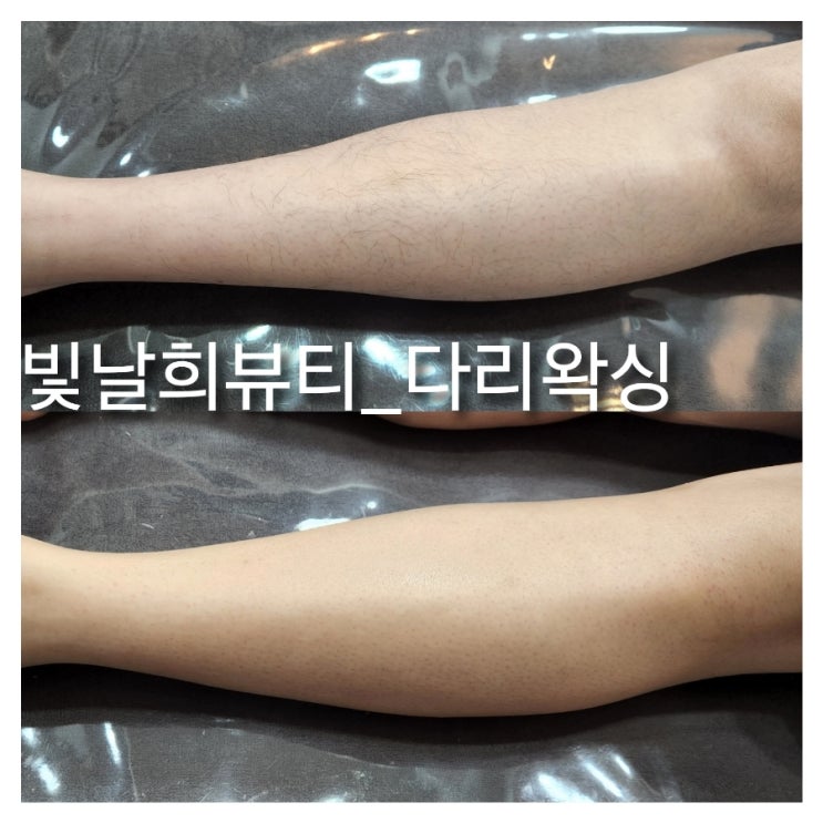  반바지 입을땐 다리왁싱 필수!