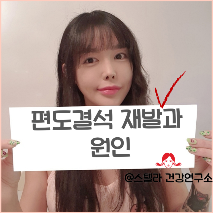  편도결석 재발과 치료 방법 알아보기