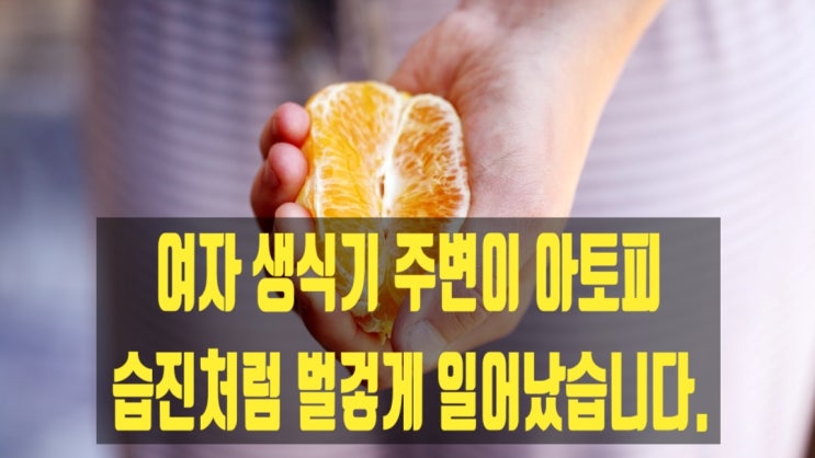  여자 생식기 주변이 아토피 습진처럼 벌겋게 일어났습니다.