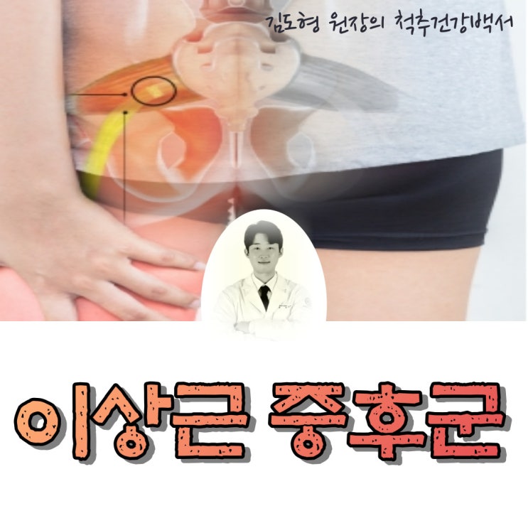  이상근증후군이란? 이상근증후군에 대한 오해, 치료