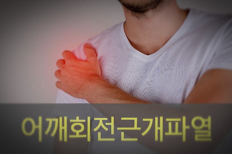  어깨 통증 원인 회전근개파열 원인과 증상, 예방, 스트레칭