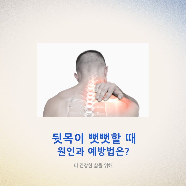  뒷목이 뻣뻣할 때 원인과 예방법은?