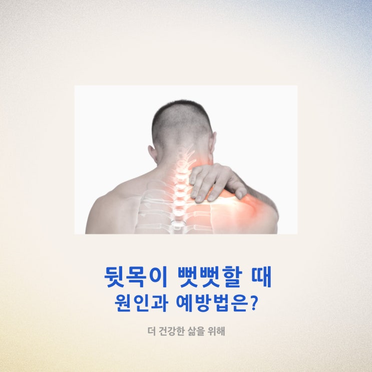 뒷목이 뻣뻣할 때 원인과 예방법은?