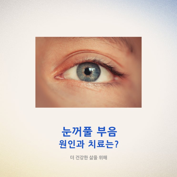  눈꺼풀 부음 원인과 치료는?