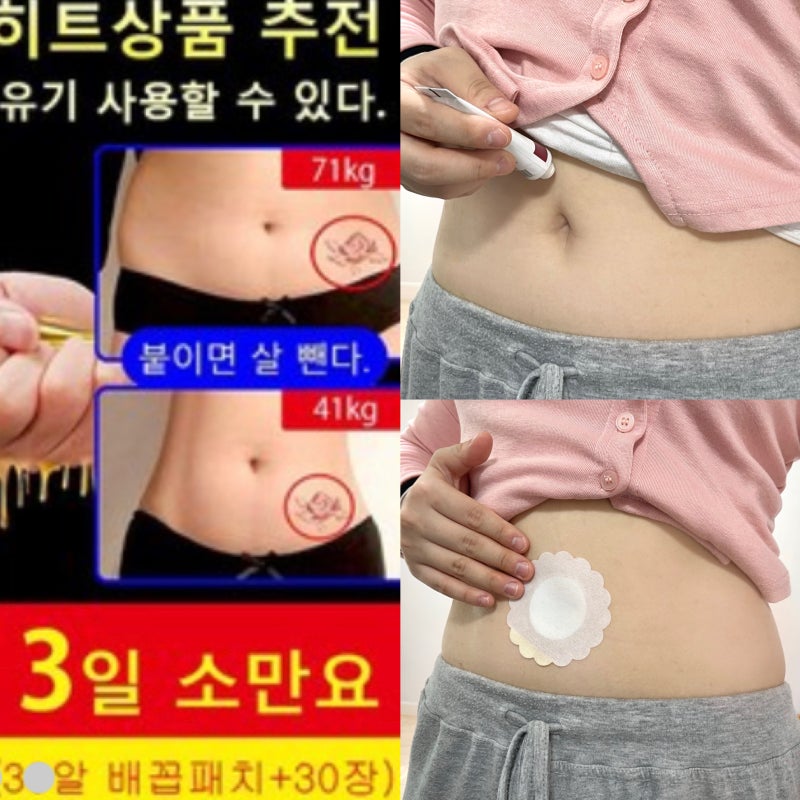 배꼽 패치 2