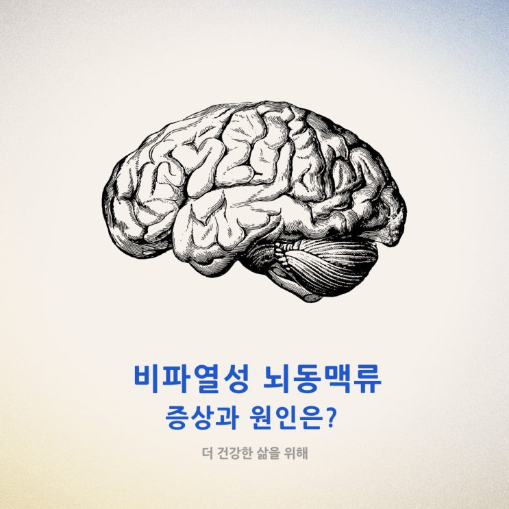  비파열성 뇌동맥류 증상과 원인은?