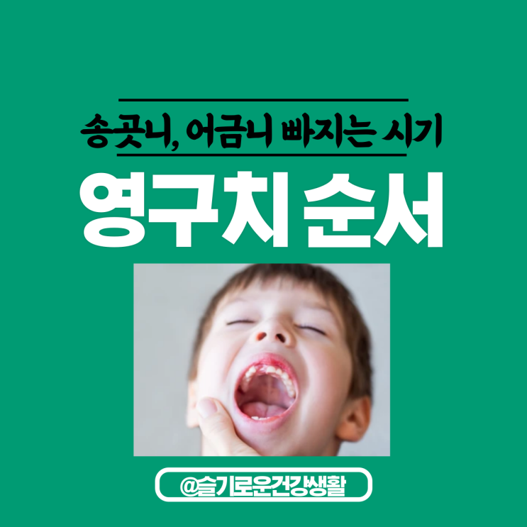  영구치 나는 순서 송곳니 어금니 빠지는 시기