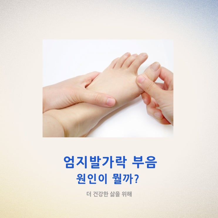  엄지발가락 통증 및 부음 원인이 뭘까?