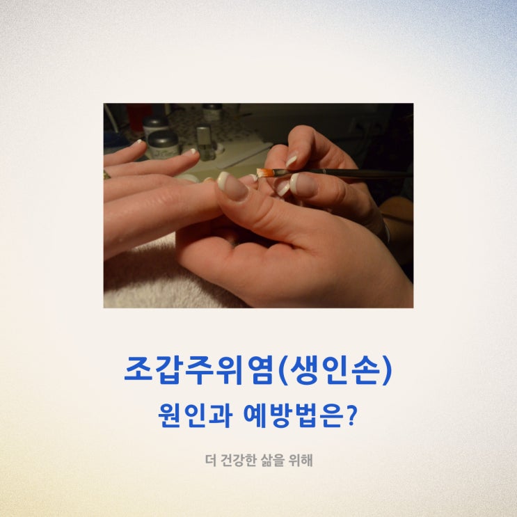  조갑주위염 생인손의 원인과 예방법은?