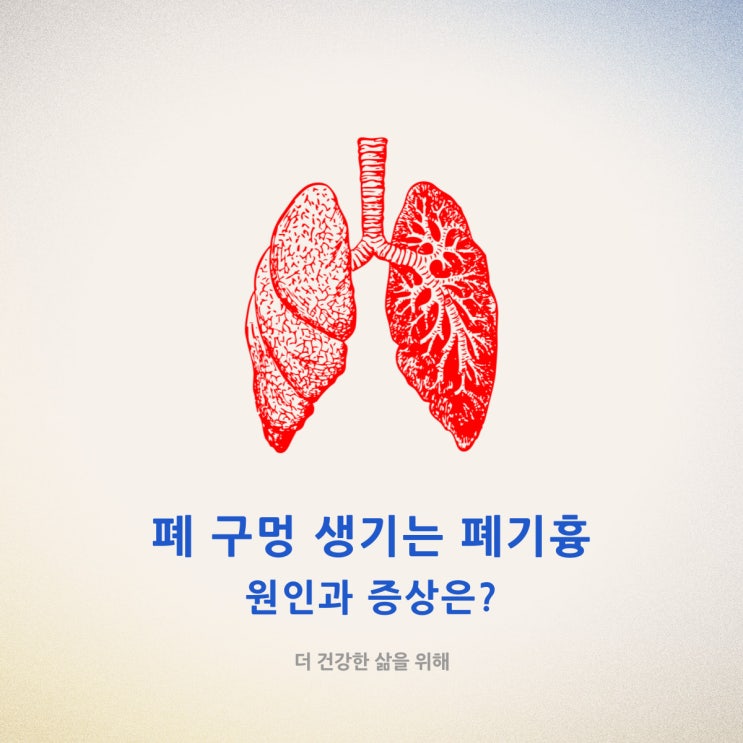 폐 구멍 생기는 폐기흉 원인과 증상은?