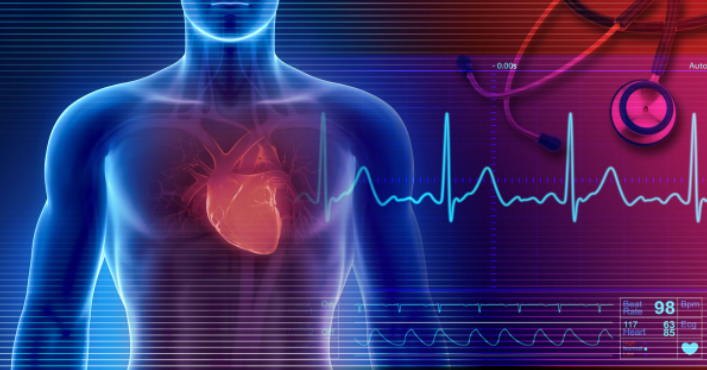  급성 심장사로 기술된 것(Sudden cardiac death, so described) I46.1