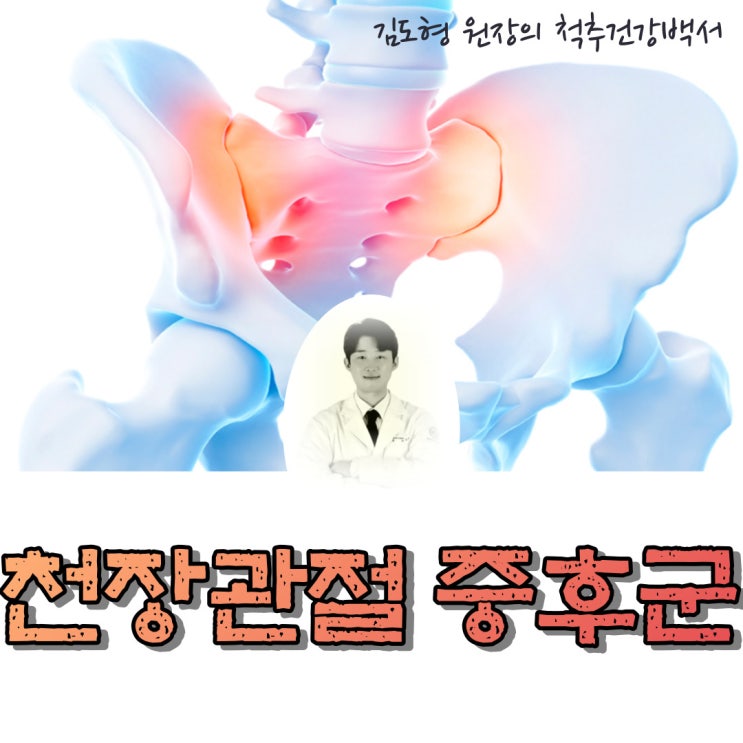  천장관절증후군 이란? (엉치통증, 엉덩이 주변 통증)