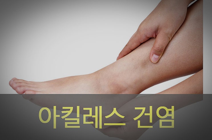  아킬레스 건염 원인과 증상, 예방, 스트레칭