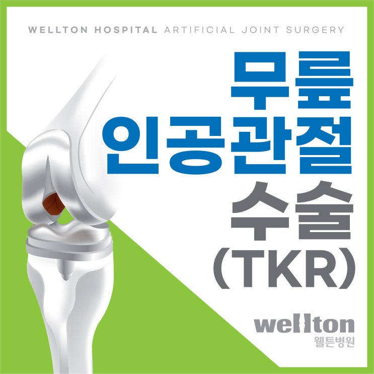  무릎 인공관절 수술 잘 하는 곳 뼈 손실 최소화 웰튼 TKR