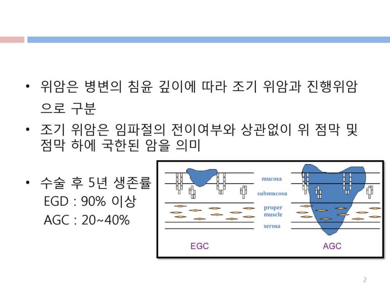 조기 위암과 진행성 위암의 분류(classification of EGC and AGC) : 네이버 블로그