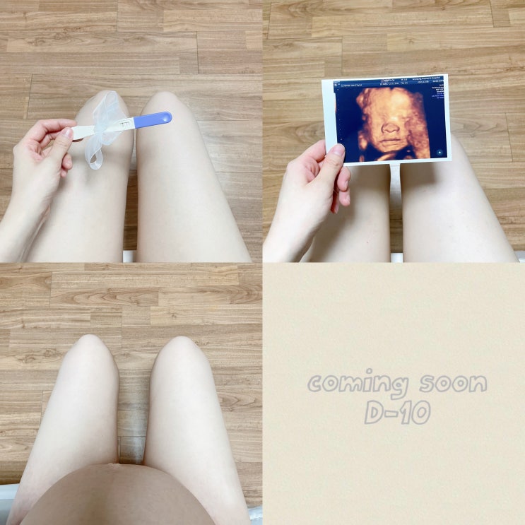  안산우성병원 제왕절개 후기 1편