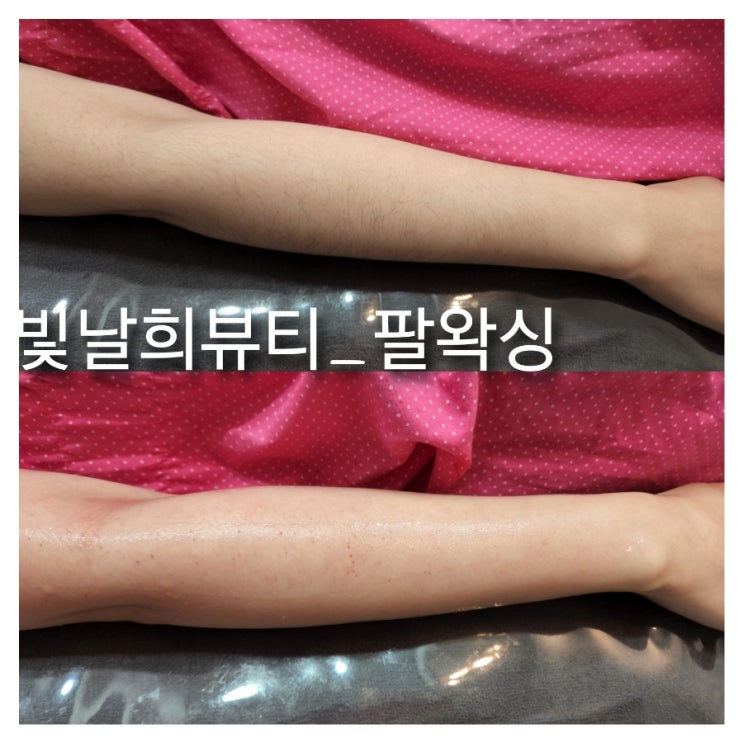  웨딩준비로 바쁜 예비신부님 화려한 웨딩드레스엔 팔전체왁싱 필수 웨딩촬영에도 꼭!