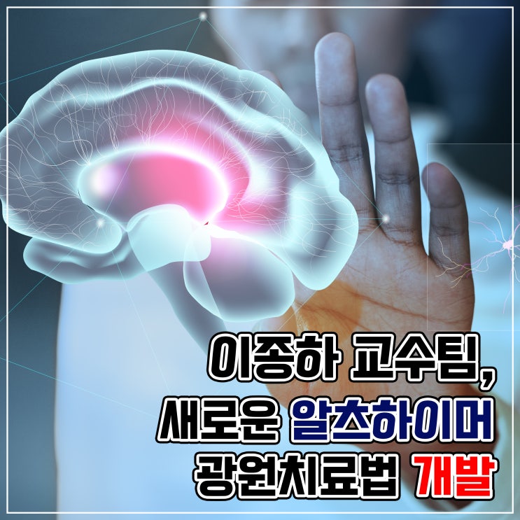  이종하 교수팀, 새로운 알츠하이머 광원치료법 개발