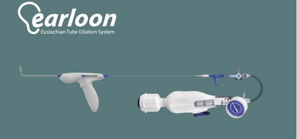 이관풍선확장술/이관풍선확장카테타/earloon/이관협착증/풍선확장술/