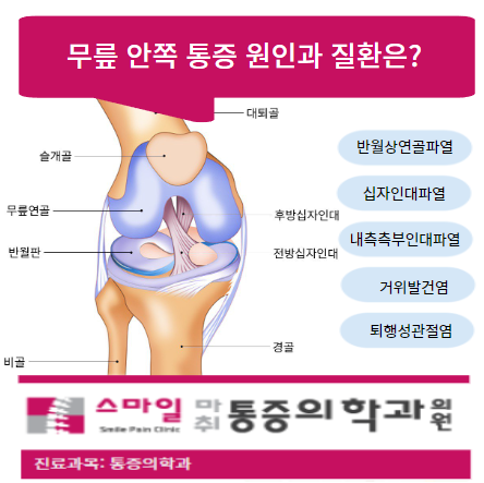  [일산무릎치료병원] 무릎안쪽통증 원인과 질환